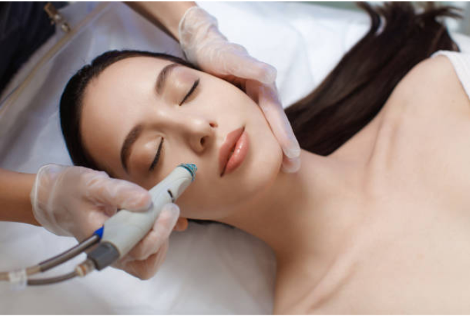 Enhancing Your Profile: A Comprehensive Guide to Nose Fillers