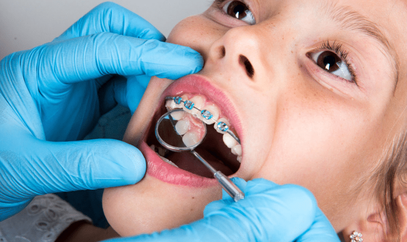 How Family Dentists Identify Early Orthodontic Needs