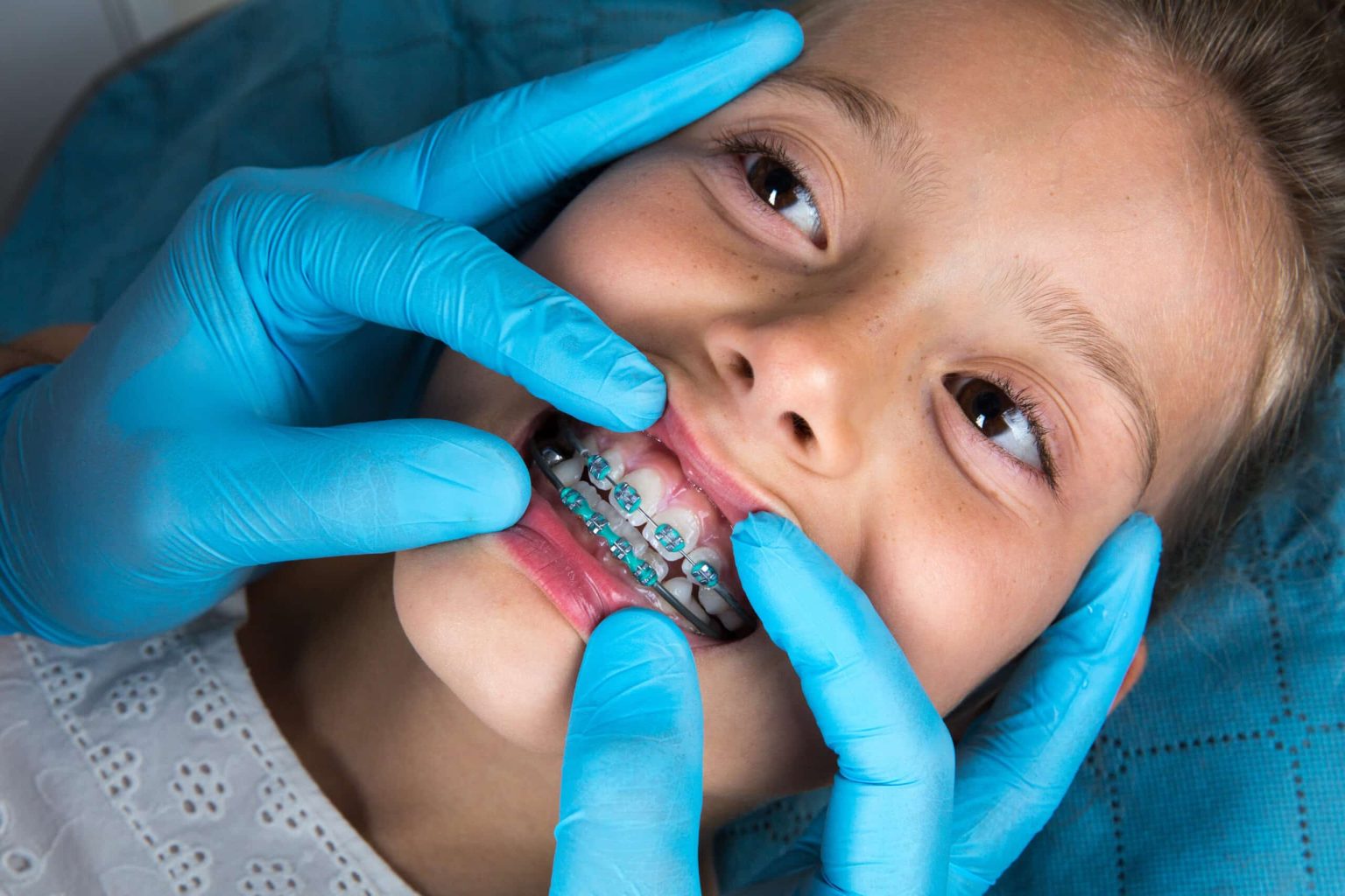 The Benefits Of Early Orthodontic Evaluation For Children