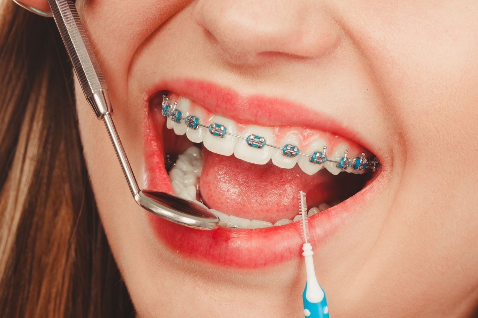 5 Ways Orthodontics Complements Cosmetic Dentistry